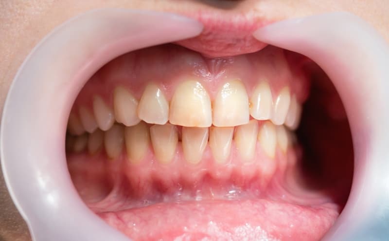 How Periodontics Supports Overall Oral Health