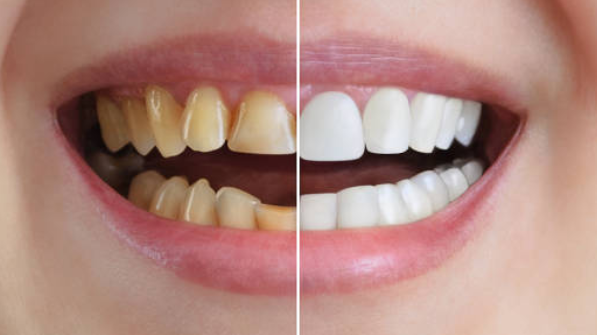 How General And Cosmetic Dentistry Boost Confidence Across All Ages