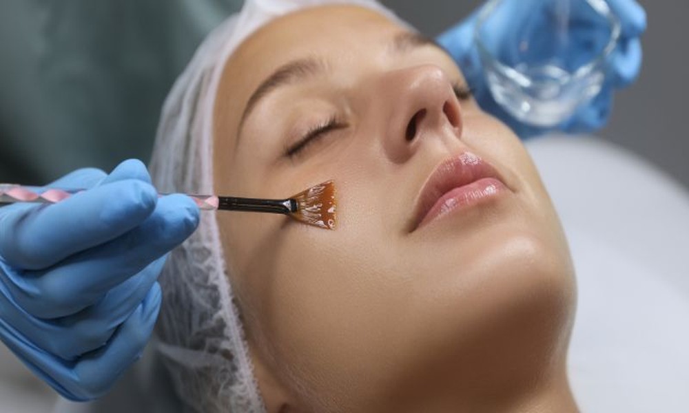 Skin Peels for Glowing Skin: Types, Benefits, and What to Expect After Treatment