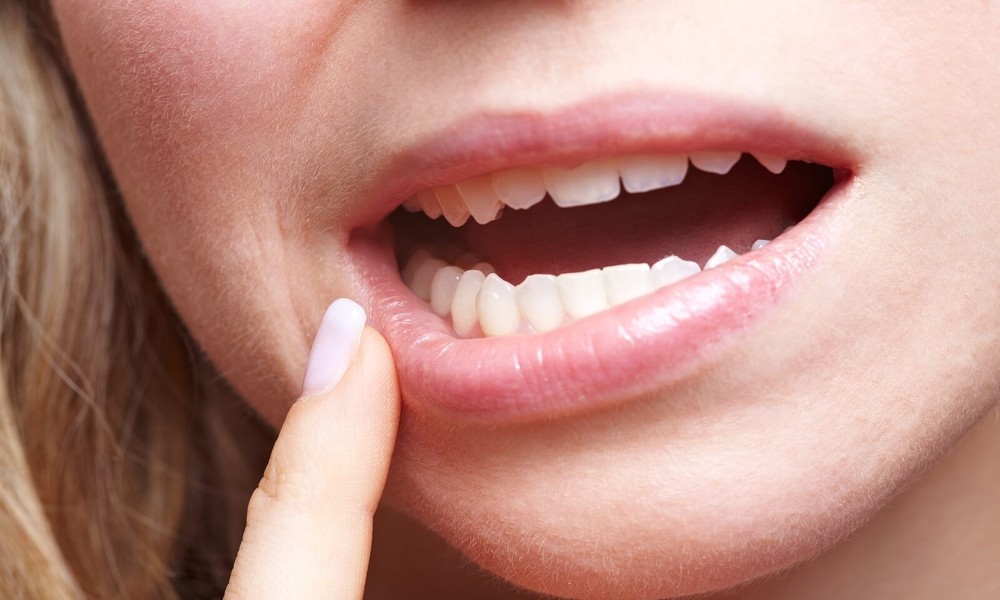 Do You Actually Need Wisdom Teeth Removal in Las Vegas?