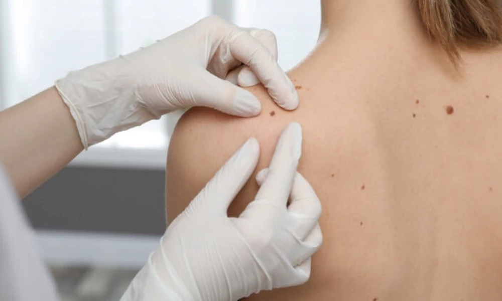 Before Your Appointment: Essential Tips for Seeing a St. George Dermatologist