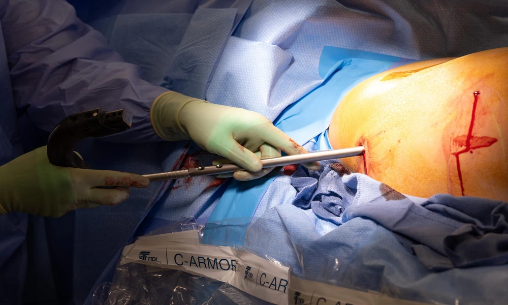 Important Factors to Consider Before Choosing Height Increase Surgery